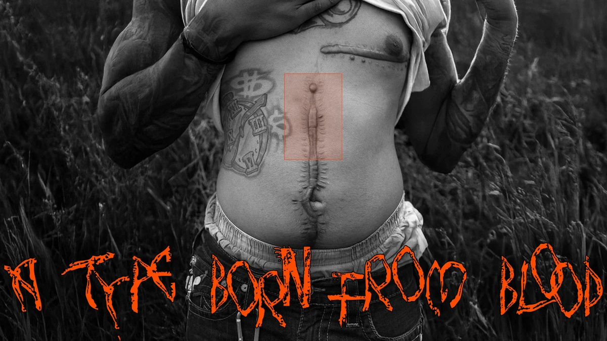 A survivor lifts his shirt to show surgical scars, with the line 'a type born from blood' set in the scar typeface.